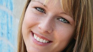 Invisible braces