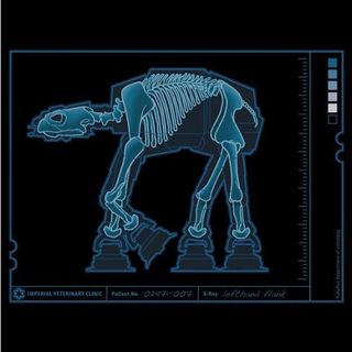 Walker X Ray