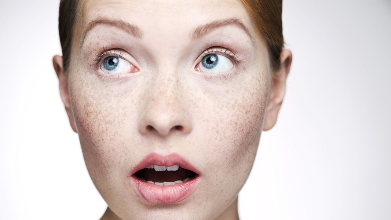 Hyperpigmented skin facial