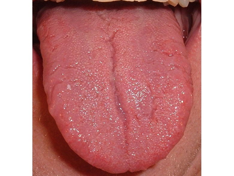 human tongues