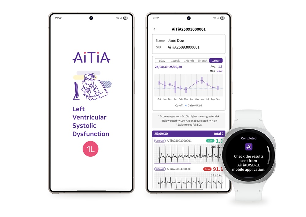 A screenshot showing the Galaxy Watch 8 with a notification from the AiTiA health app, showing the results of an LVSD test.