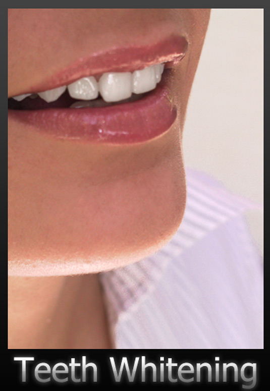 Free Photoshop actions: Teeth whitening