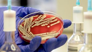 a scientist's hand, covered by a purple glove, holds a petri dish with visible e. coli colonies growing on it