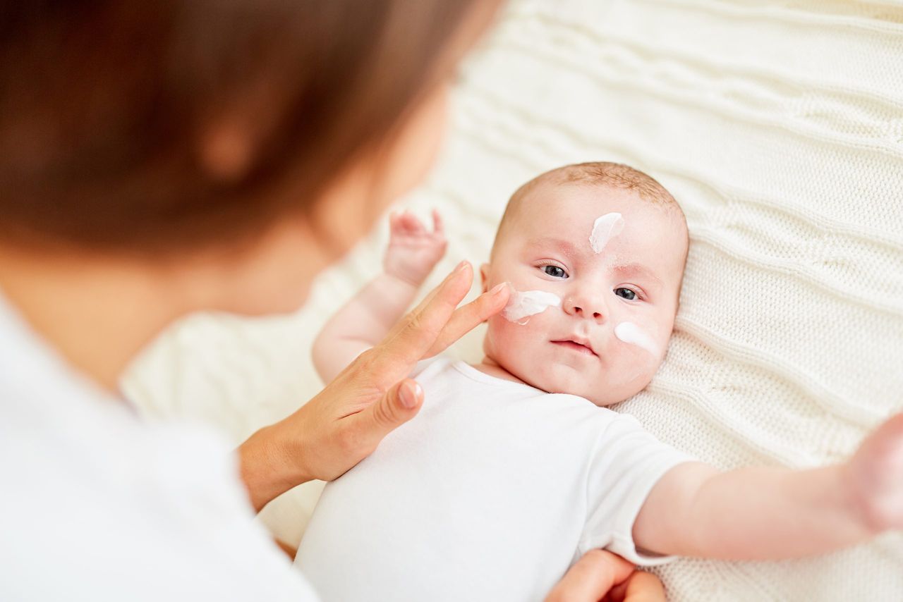 baby with eczema