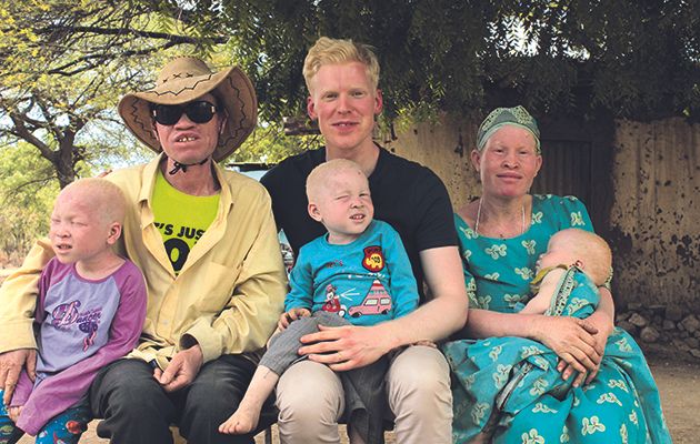 NHS doctor Oscar Duke, who you might recognise from 24 Hours in A&amp;E, has albinism: a lack of melanin in the body.