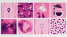 Photo collage of a diagram of female genitalia; a photo of scattered pills; a hand holding a sealed condom; an illustration of a vial and beaker; a microscope photo of syphilis bacterium; an organic, bubbling ink spill; a diagram of male genitalia; and a photo of overlapping confetti paper dots