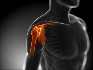 shoulder injuries, bone, joint, rotator cuff, tendinitis, bursitis