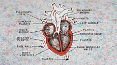 Photo and illustrative collage of a diagram of a heart on a background of shredded plastic. The diagram descriptions show plastic in many parts of the heart diagram.