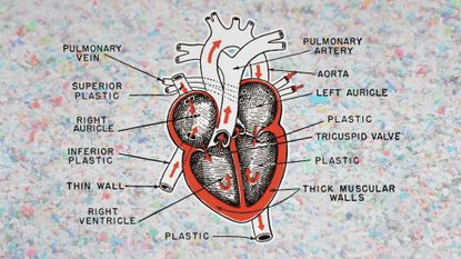 Photo and illustrative collage of a diagram of a heart on a background of shredded plastic. The diagram descriptions show plastic in many parts of the heart diagram.
