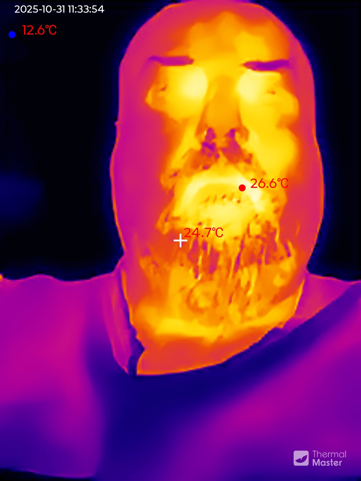 Thermal Master P1 Example captures