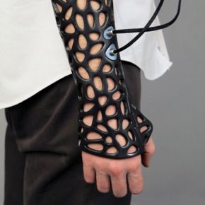 Innovation of the week: A high-tech cast