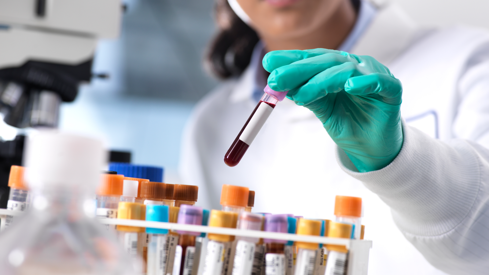Female scientist preparing a blood sample for clinical testing in the laboratory.