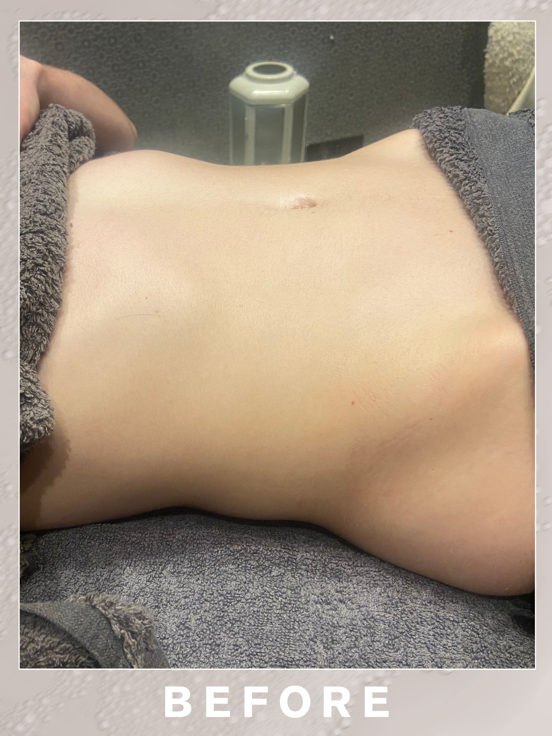 Beauty editor Eleanor Vousden before getting a lymphatic drainage massage