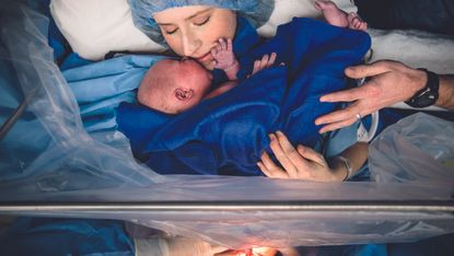 Caesarean section and childbirth