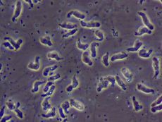 A prepared slide of Naegleria fowleri taken from a patient with primary amebic meningoencephalitis.