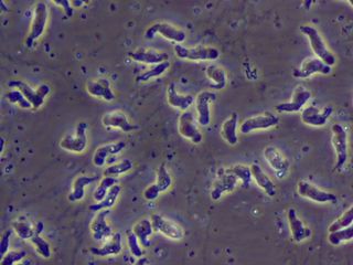 A prepared slide of Naegleria fowleri taken from a patient with primary amebic meningoencephalitis.