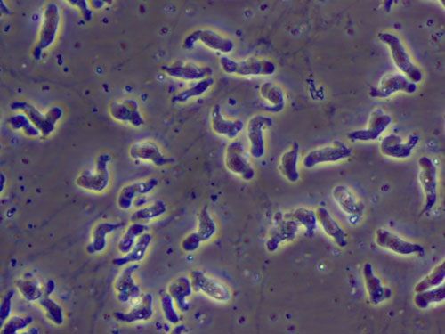 A prepared slide of Naegleria fowleri taken from a patient with primary amebic meningoencephalitis.