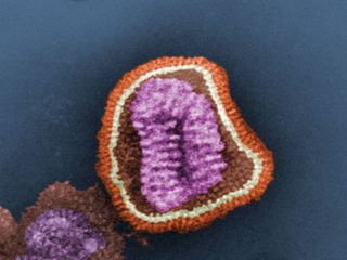 An influenza virus particle.