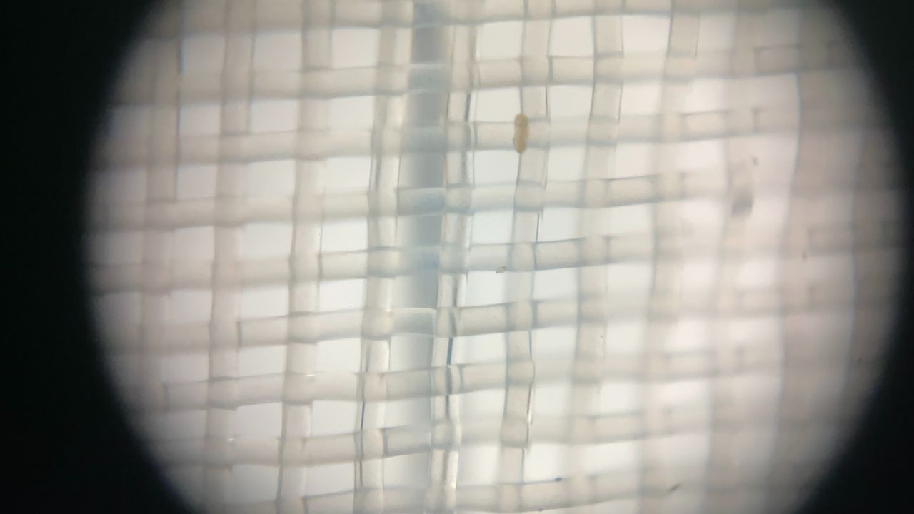 iMicro Q3p fingertip smartphone microscope
