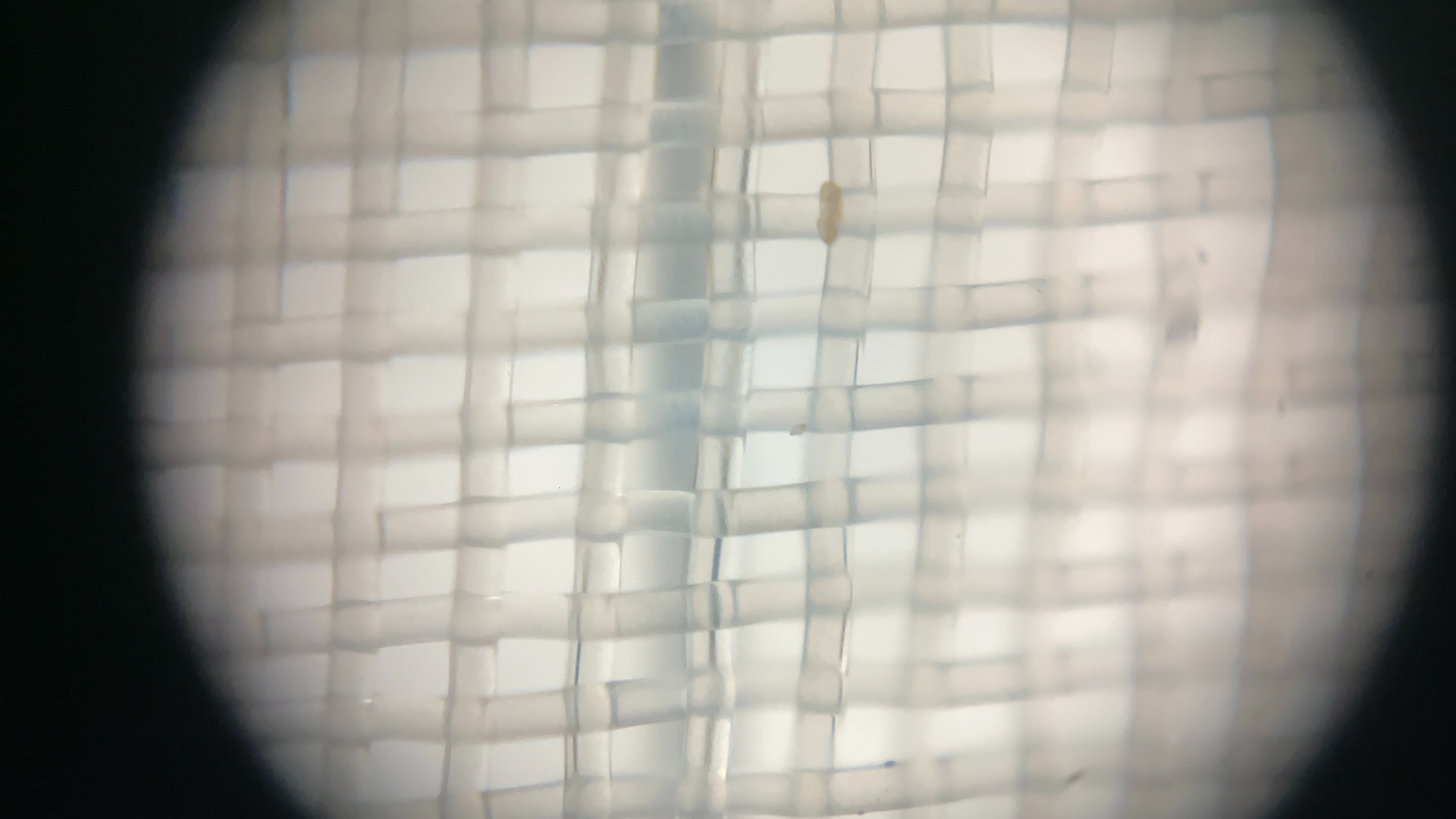 iMicro Q3p fingertip smartphone microscope