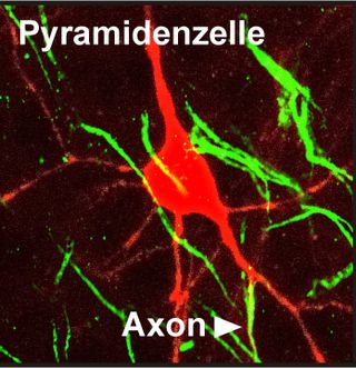 A neuron with an axon protruding directly from a dendrite rather than from the cell body.