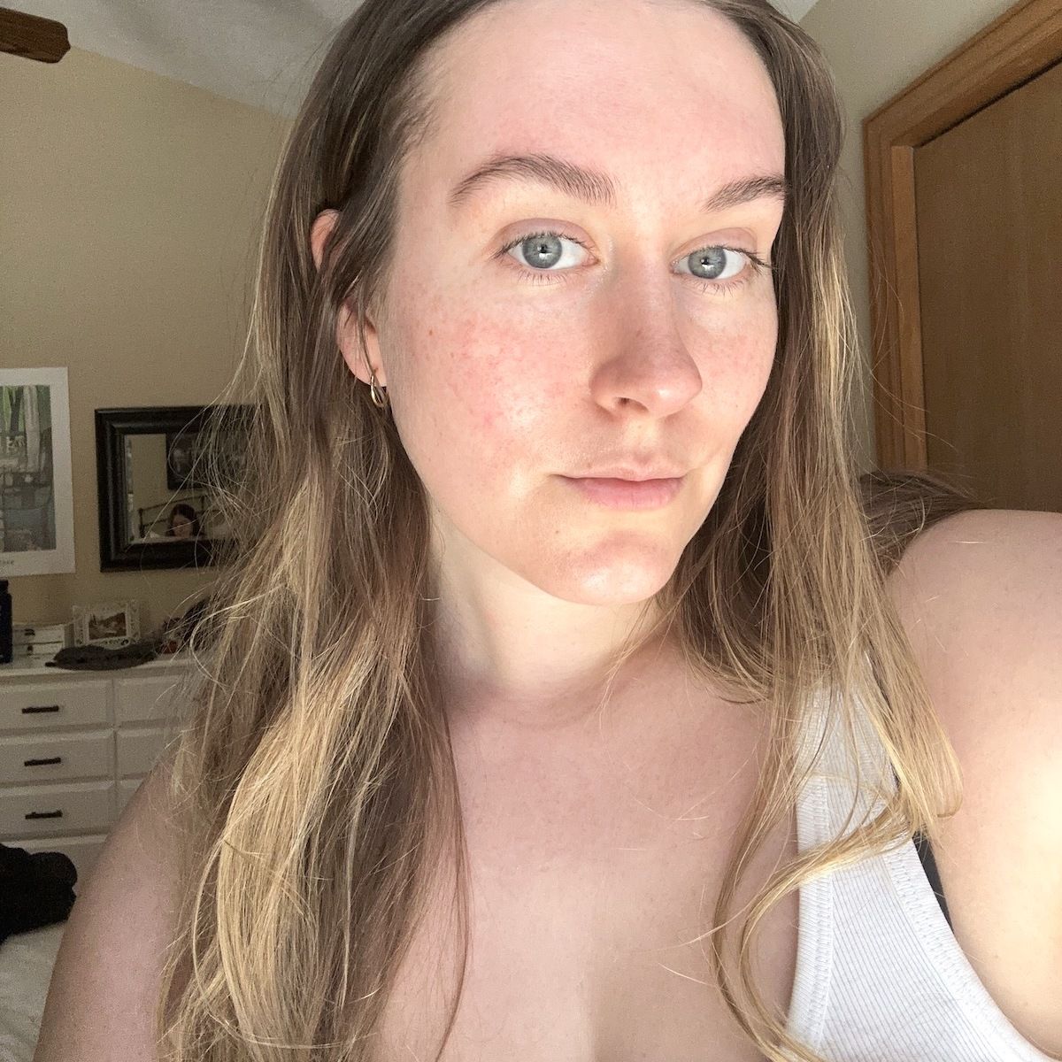 I Tried This At-Home Micro-Needling System—Now, My Favorite Concealers Are Collecting Dust