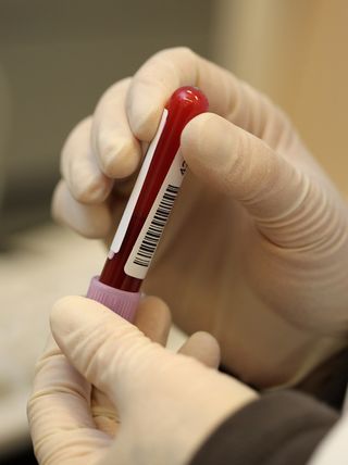 Blood samples in doping control