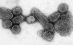 Electron micrograph of recreated 1918 influenza in 2005.