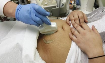 A clinical assistant performs an ultrasound sonogram on an abortion patient: In Tennessee, anti-abortion lawmakers are pushing a new bill that would release the names of doctors who perform a