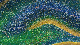 An image of the rat hippocampus taken with a laser microscope, showing small neurons in green, yellow and blue. The hippocampus is a key brain region for memory formation.