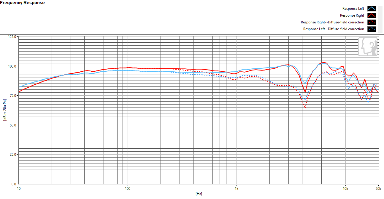 Frequency response