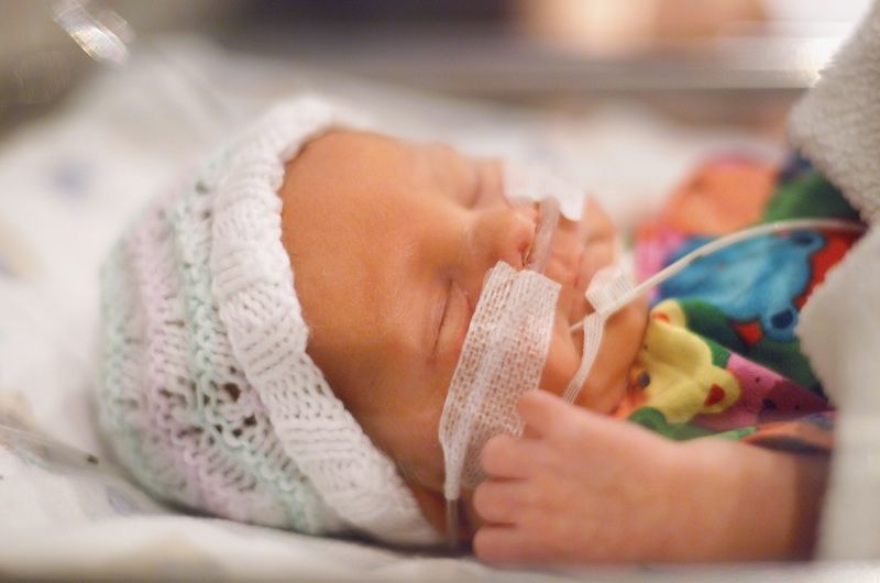 Premature baby in hospital