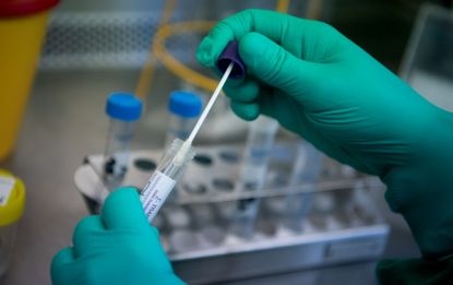 A coronavirus test is processed