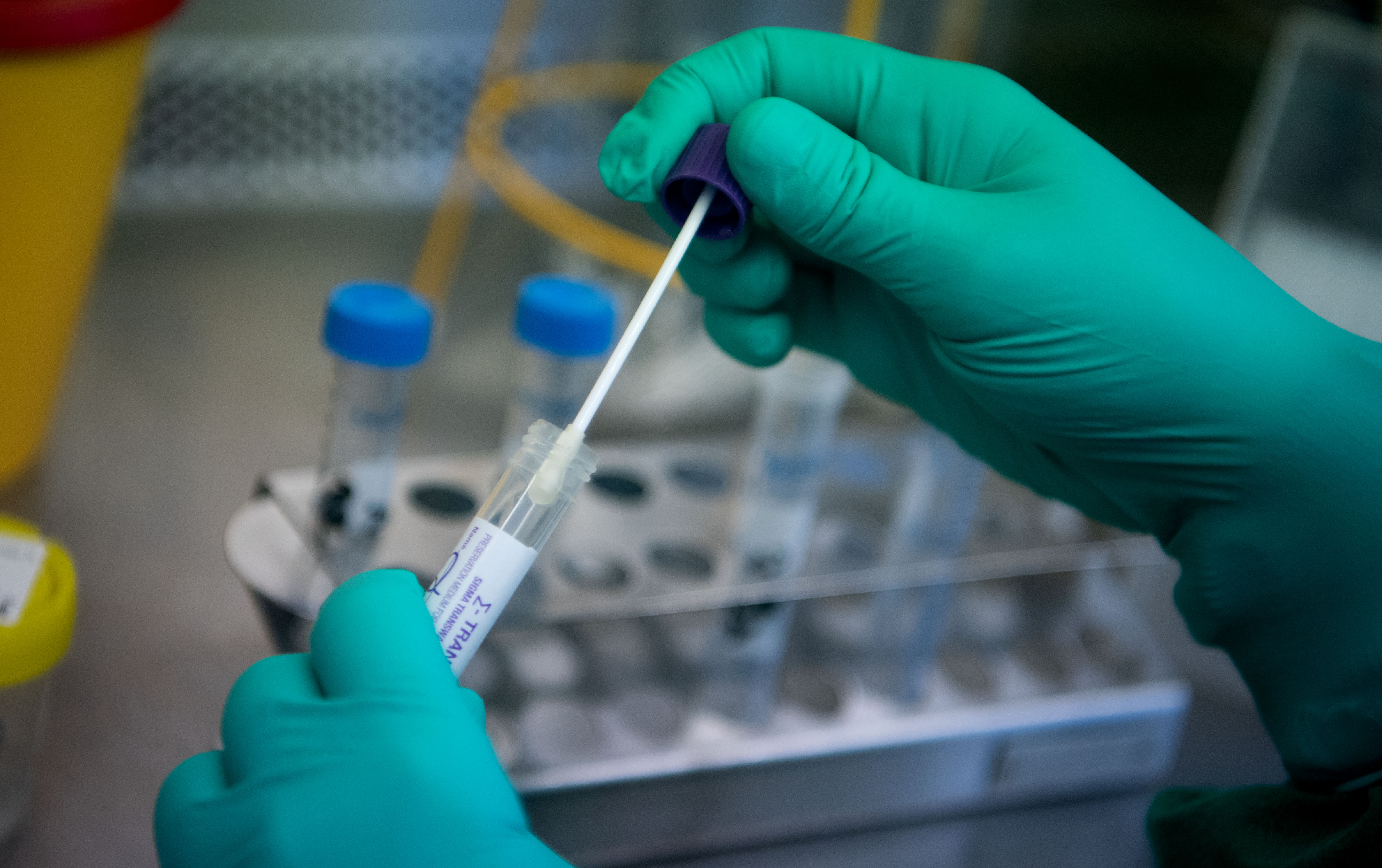 A coronavirus test is processed