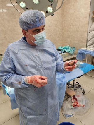 A Ukrainian surgeon holding the unexploded grenade after removing it from a soldier's chest.
