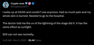 I woke up at 04:00 and couldn’t see anymore. Had so much pain and my whole skin is burned. Needed to go to the hospital. The doctor told me the uv of the lightning of the stage did it. It has the same effect as sunlight. Still can not see normally..