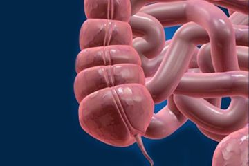how to tell if your appendix burst how to tell if your appendix burst