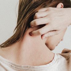 Woman scratching her back - Eczema treatment