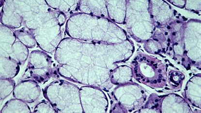 Light micrograph of human sublingual salivary gland with mucus cells and a duct