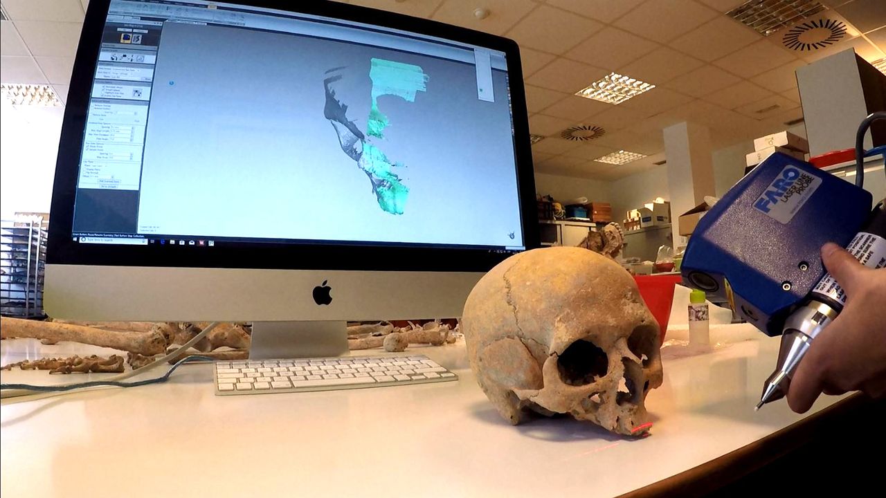 A skull is laser scanned so that it can undergo a facial reconstruction.