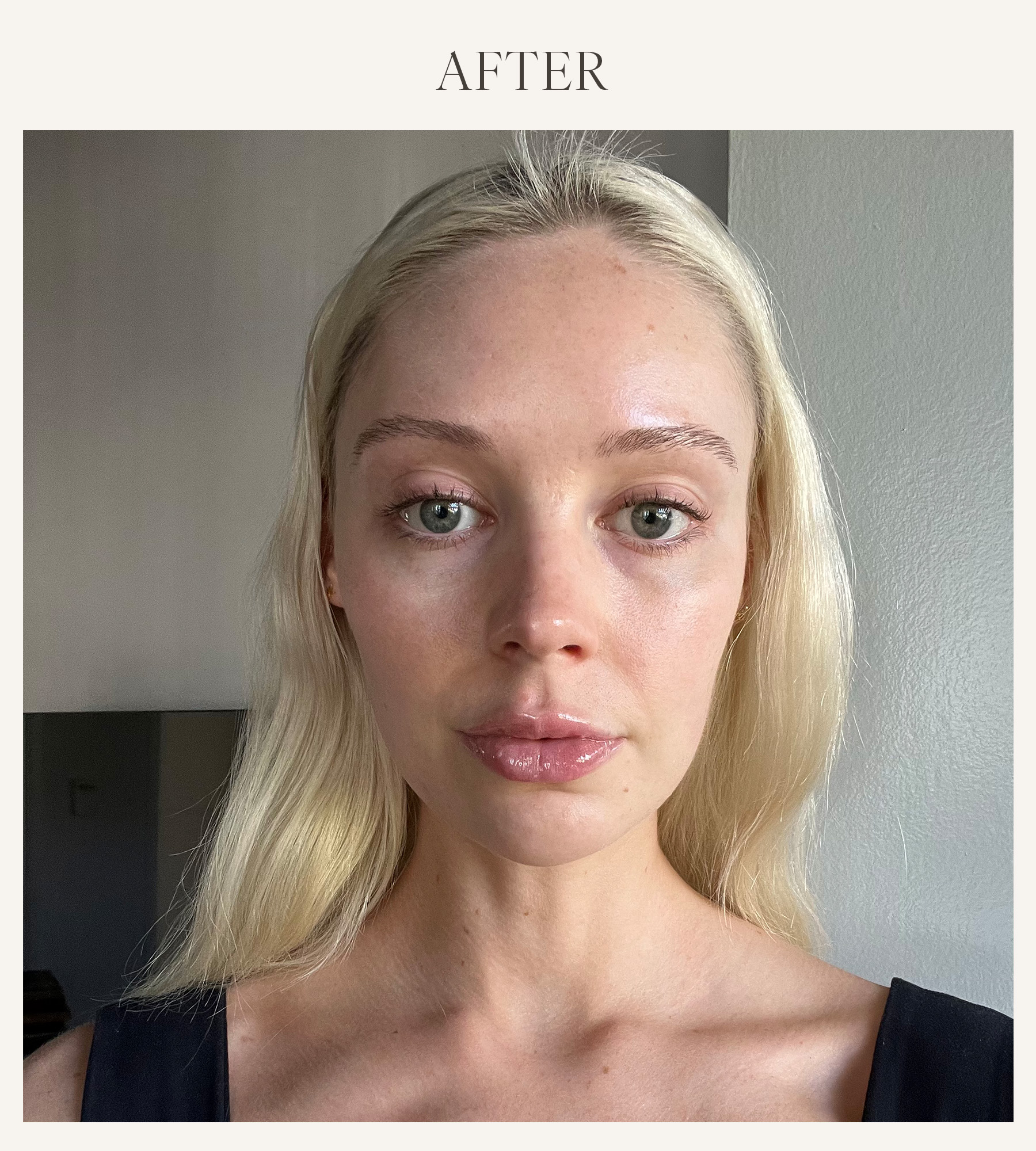 After photo of Erin Jahns testing the Buxom lip plumper 