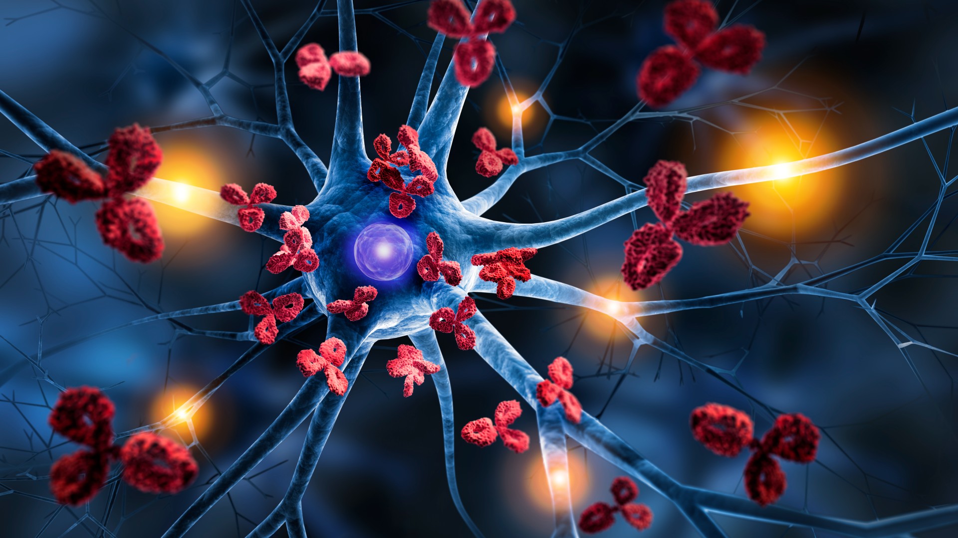 Medical illustration of a nerve cell, in blue, being attacked by antibodies, in red