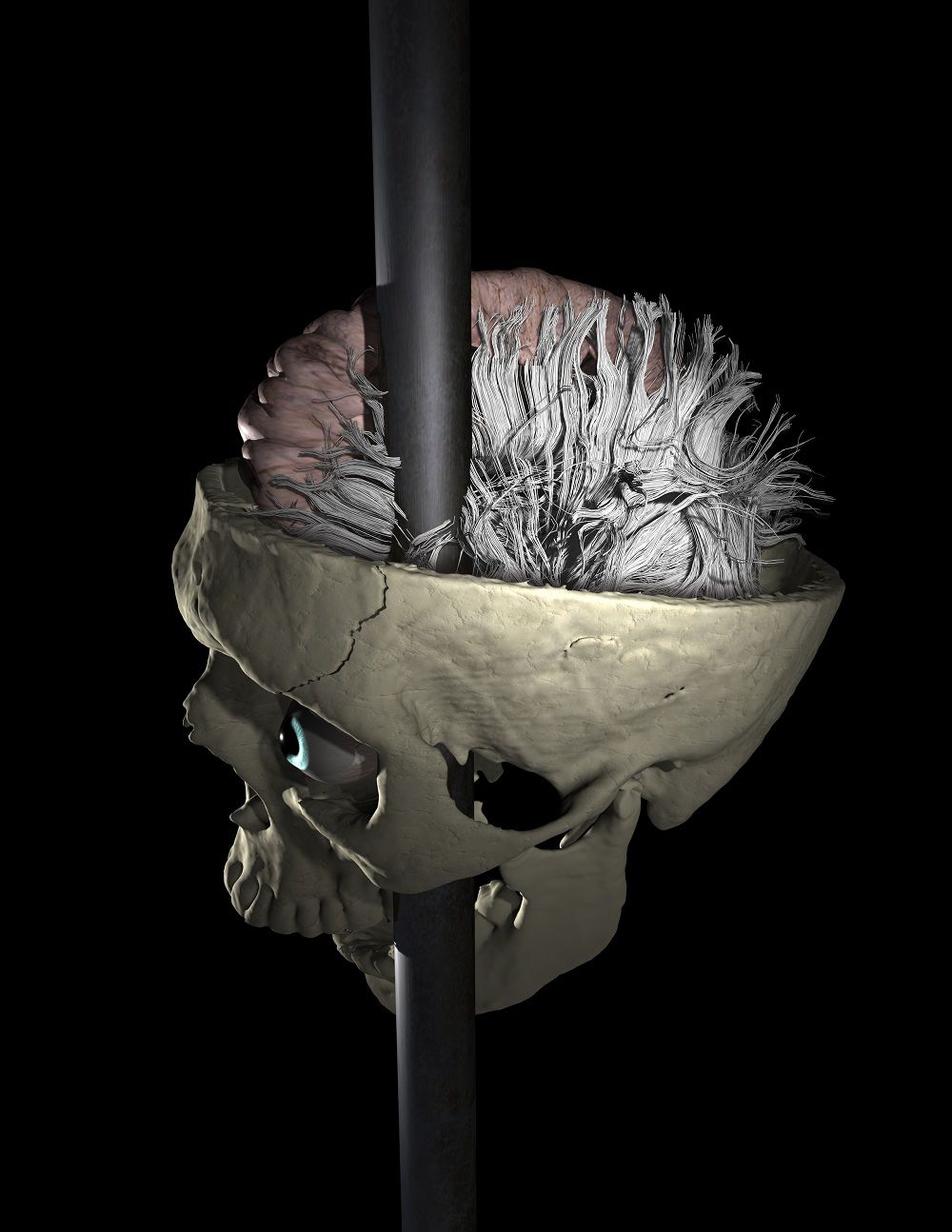 Image of the rod passing through Phineas Gage&#039;s skull and brain.