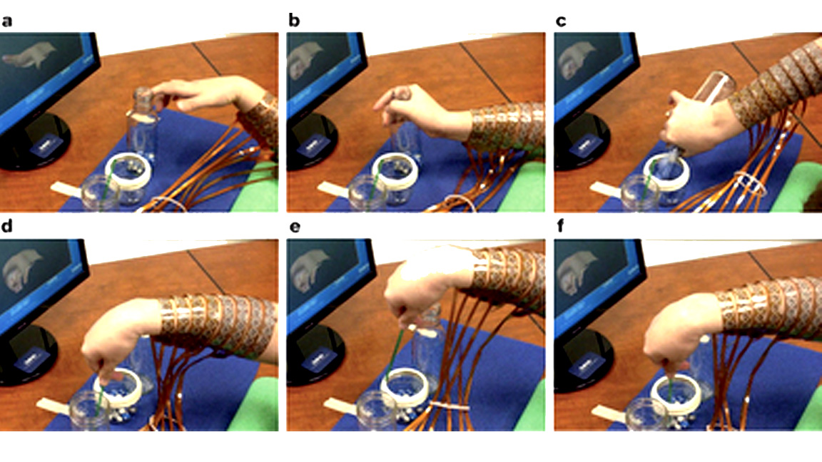 A brain implant just gave a paralyzed man control of his fingers