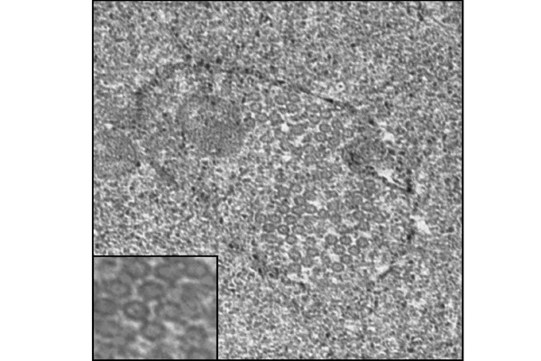 A Wolbachia cell infected with bacteriophages.