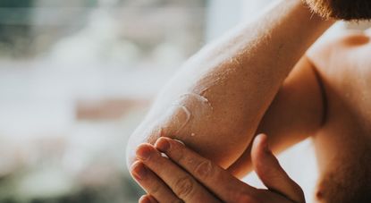 11 proven sunburn remedies: How to get rid of sunburn at home | GoodTo