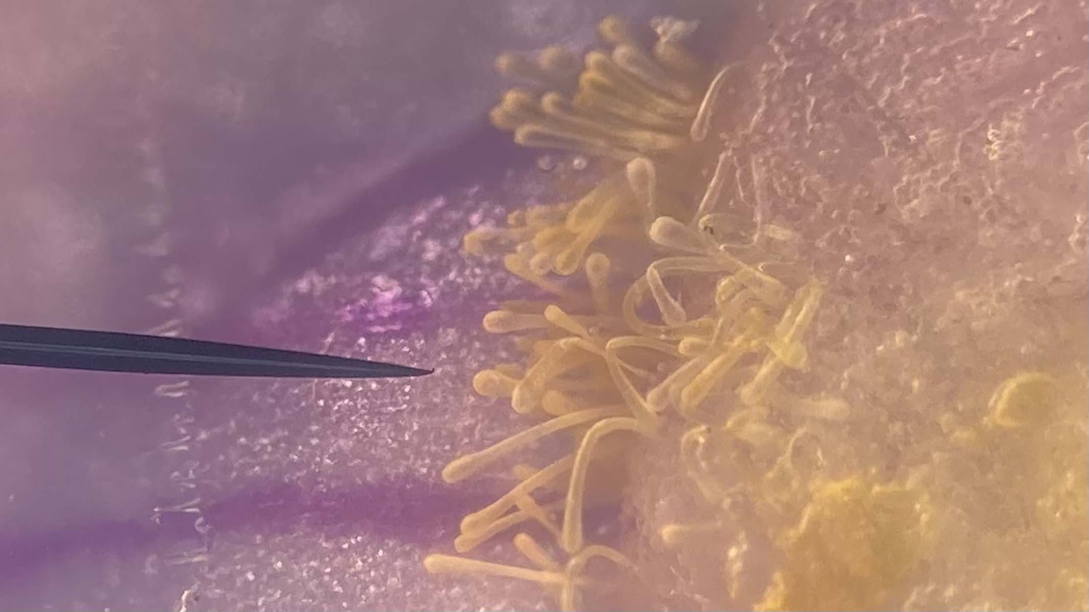 photographing a microscope specimen