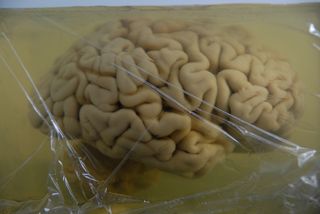 The brain of H.M. is embedded in a gelatin block.