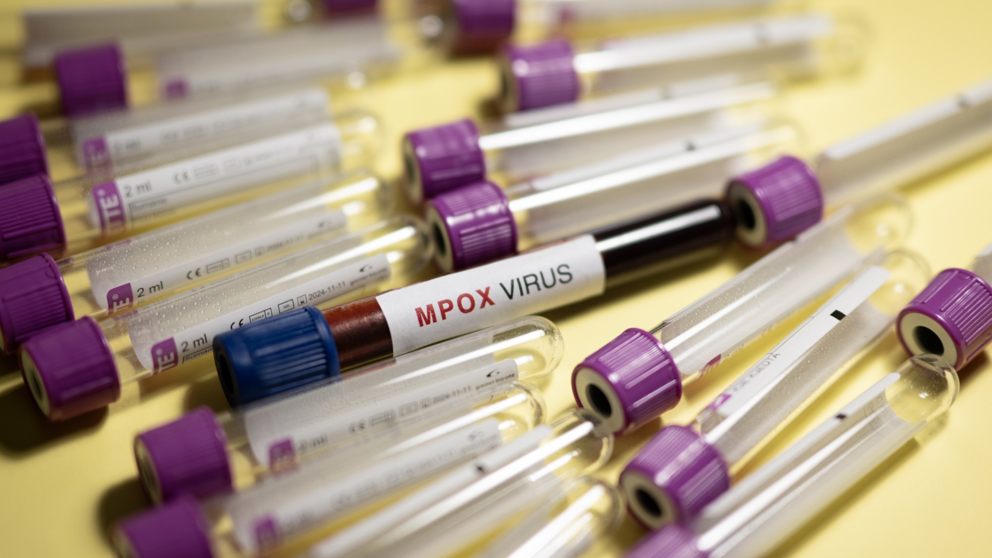 Vials of the mpox virus are seen in a photo from Ankara, Turkey. 