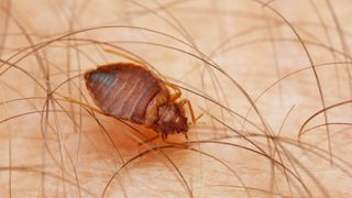 A bed bug on the skin